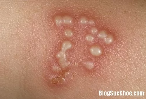 Nguyên nhân thường gặp khiến âm đạo bị đau