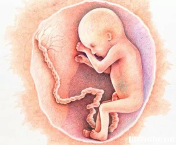 Sa dây rốn - "cơn ác mộng" của các bà bầu