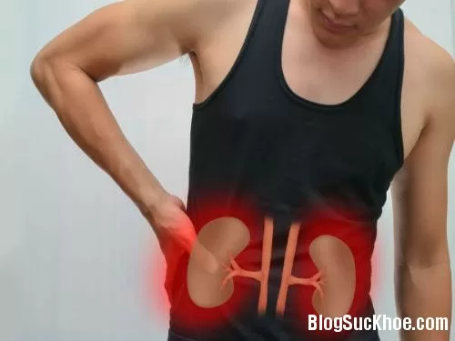 Loại nước giúp sỏi thận tự khắc chui ra