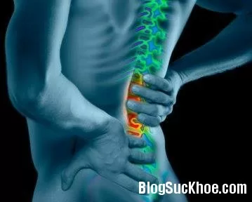 Bị thoát vị đĩa đệm nằm ngủ như thế nào là đúng?