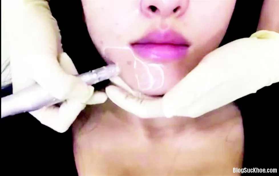 Cấy phấn cho da liệu có an toàn?