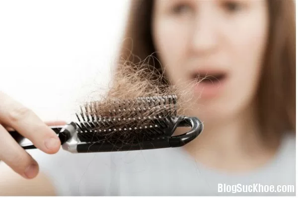 Rụng tóc là dấu hiệu bệnh gì?