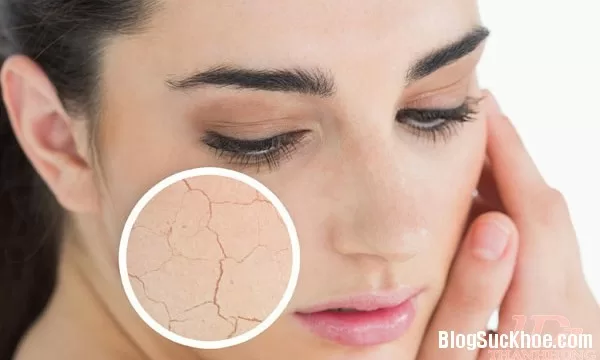 Dưỡng da chống nứt nẻ khô ráp mùa đông