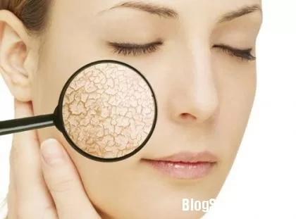 Chế độ ăn uống trị khô da hiệu quả