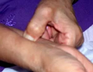 Xoa bóp hỗ trợ điều trị viêm túi mật hiệu quả giúp giảm đau nhanh