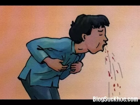 Nôn ra máu và cách xử trí