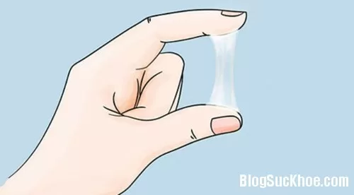 Dấu hiệu viêm lộ tuyến cổ tử cung chị em thường chủ quan