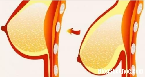Lời khuyên vàng giúp ngực tránh “chảy xệ”
