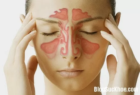 Một số cách chữa viêm xoang tại nhà