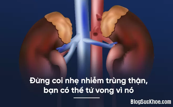 Một số triệu chứng nhiễm trùng thận nguy hiểm