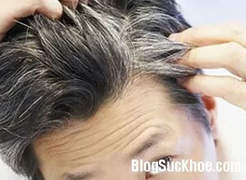 Đối phó tình trạng tóc bạc sớm