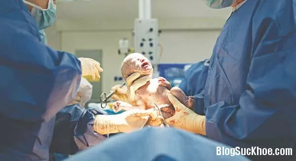 Sinh thường và sinh mổ lợi hại như thế nào?
