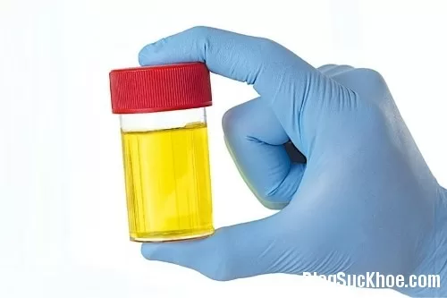 Sự thật ít biết về nước tiểu