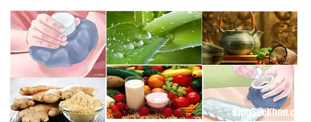 Biện pháp điều trị mề đay tự nhiên tại nhà