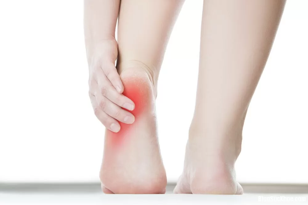 Những bài thuốc Đông y giúp chữa đau gót chân