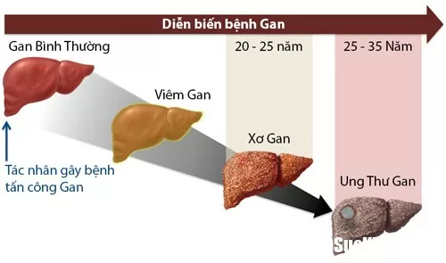 Bí quyết để có một lá gan khoẻ mạnh