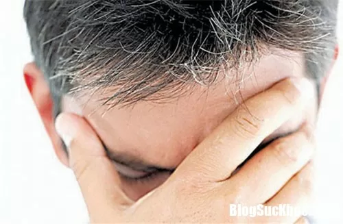Tóc bạc sớm là bệnh gì ?