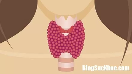Nhận biết bệnh ung thư tuyến giáp qua những dấu hiệu này