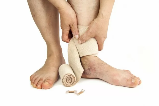 Những dấu hiệu nhận biết chứng đông máu