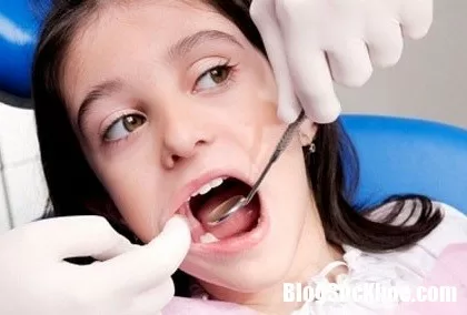 Những điều cần biết về bệnh sâu răng