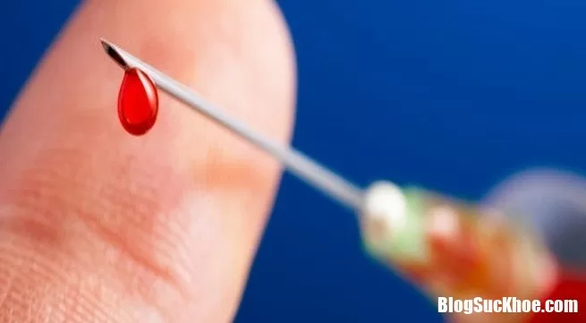 Khi nào thì dễ bị phơi nhiễm HIV