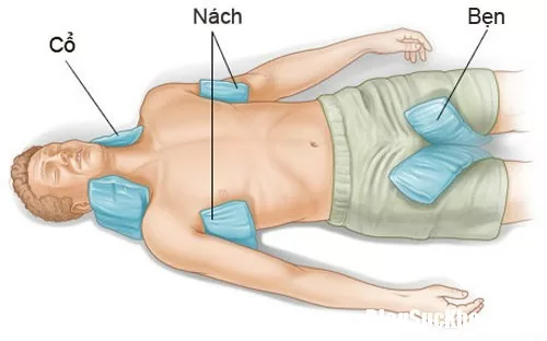 Cách xử lý kịp thời khi có người say nắng