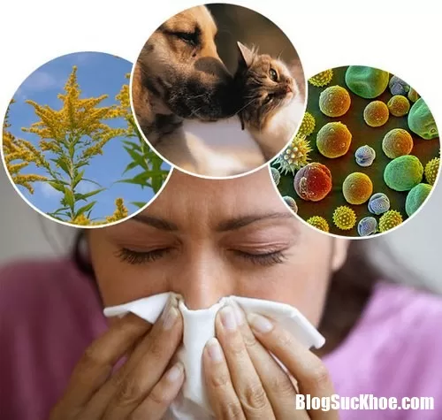 Những căn bệnh dị ứng đang ngày càng phổ biến