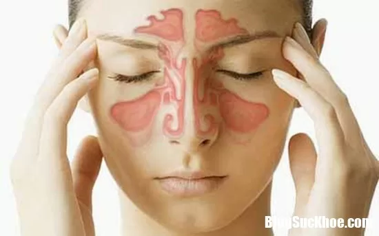 Hết khó chịu với cơn buốt viêm xoang trong vòng 20 giây