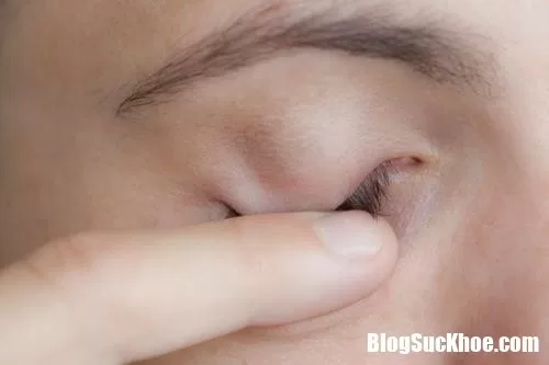 Thoát khỏi cận thị và viễn thị nhờ những mẹo và kỹ thuật độc đáo