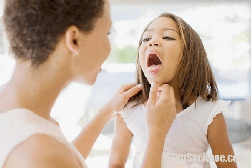 Những biến chứng nghiêm trọng của bệnh viêm họng