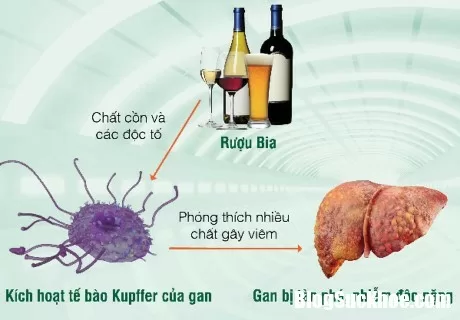 Điểm mặt những thủ phạm gây nên xơ gan, ung thư gan