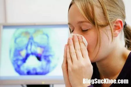 Những điều cần biết về bệnh viêm xoang