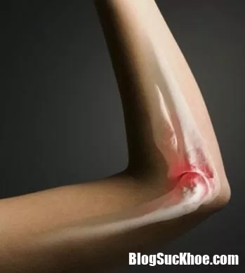 Dấu hiệu nhận biết ung thư xương