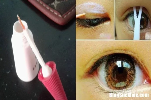 Sử dụng keo dán và miếng dán kích mí rởm dễ gây hỏng mắt