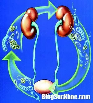Nhận biết bệnh nhiễm khuẩn đường tiểu ở trẻ