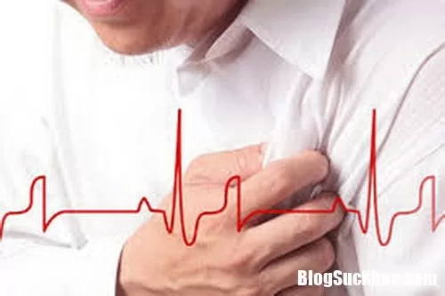 Đột quỵ và cơn đau tim khác nhau thế nào ?