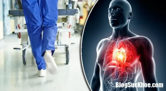 Những dấu hiệu mới cảnh báo cơn đau tim