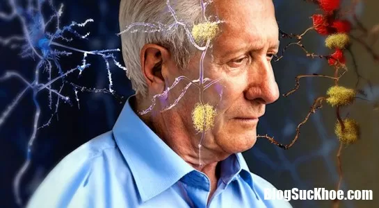 Nghiên cứu loại thuốc mới ngừa Alzheimer hiệu quả