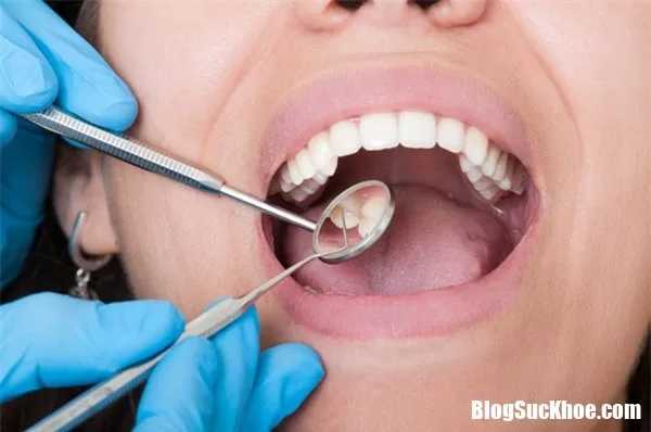 4 dấu hiệu cảnh báo bệnh nguy hiểm thường nhìn thấy ở miệng