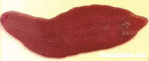 Báo động thói quen ăn đồ sống gây nhiễm giun, sán