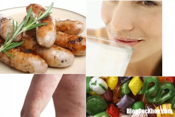 Chế độ ăn uống cho người bị viêm da dị ứng