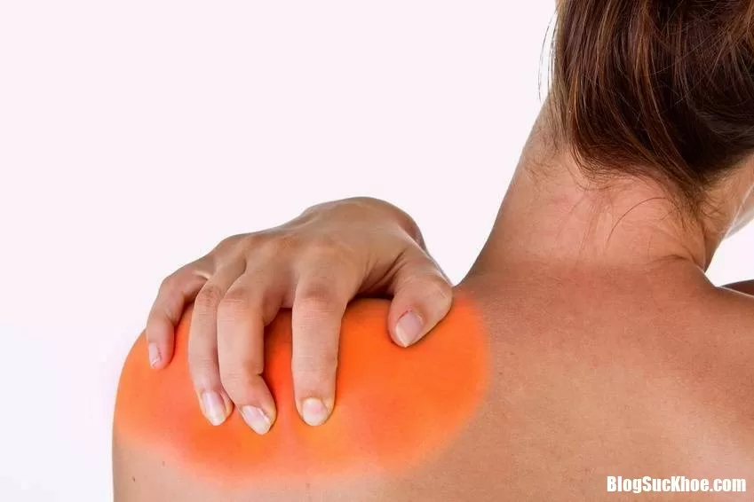 Hiểu đúng về tình trạng đau nhức xương khớp vai