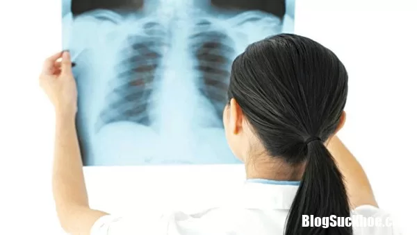 Chớ nên coi thường mà lơ là khi bị ho, có đờm kéo dài