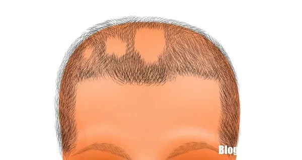 Những dấu hiệu nguy hiểm ở trẻ cần được đưa đi bác sĩ gấp