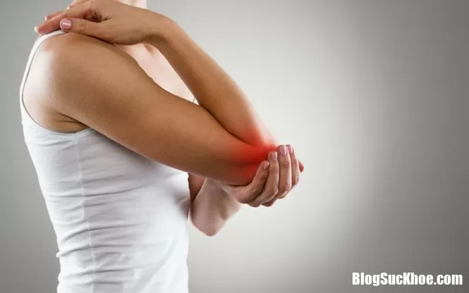 Những dấu hiệu cho thấy bạn đã bị viêm khớp