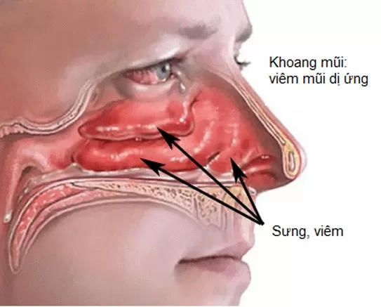 Mùa thu đông uống nước nóng thu về vô số lợi ích cho sức khỏe