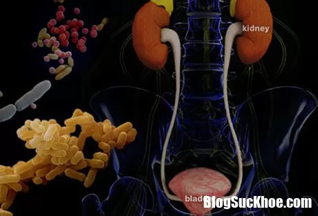 Những triệu chứng nhiễm trùng đường tiết niệu cần được lưu ý