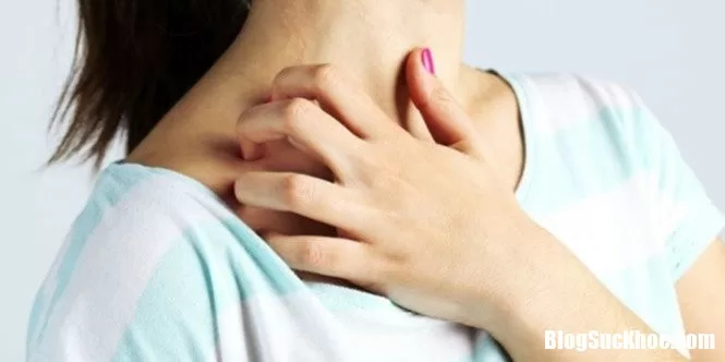 Nếu có những dấu hiệu này cần đi khám da liễu
