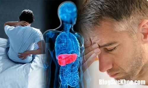 Bệnh ung thư gan và những hiểu lầm tai hại thường gặp