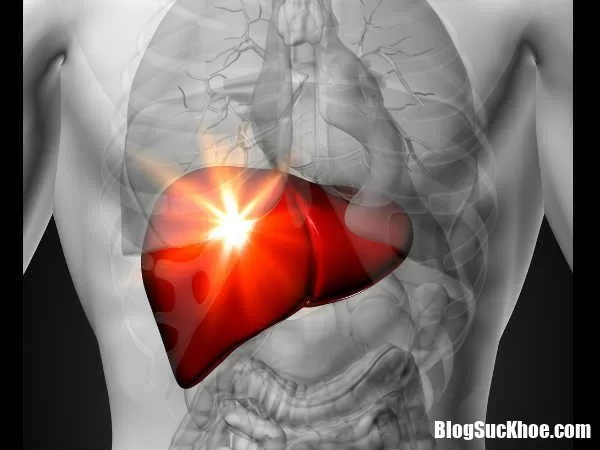 Nếu thấy những dấu hiệu này, hãy cẩn thận gan của bạn đang nhiễm mỡ